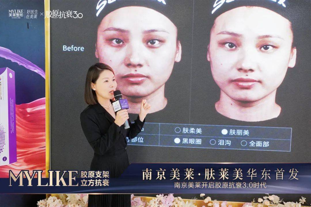 　　谭小梅主任分享胶原蛋白眼周/口周注射的临床经验