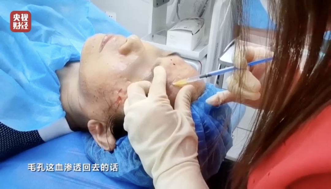 △顾客现场被注射化妆品