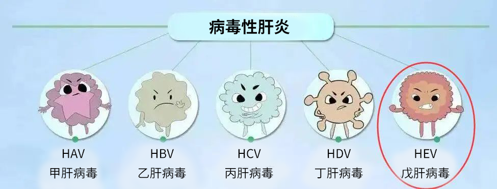 戊肝是戊型病毒性肝炎的简称,是一种由戊型肝炎病毒引起的,以肝脏损害