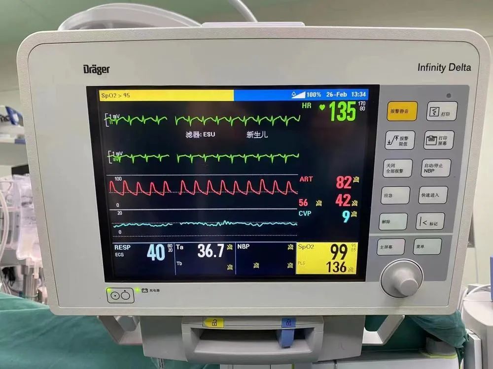 希希心脏在受捐患儿体内复跳后的心电监护仪画面.(受访者供图)