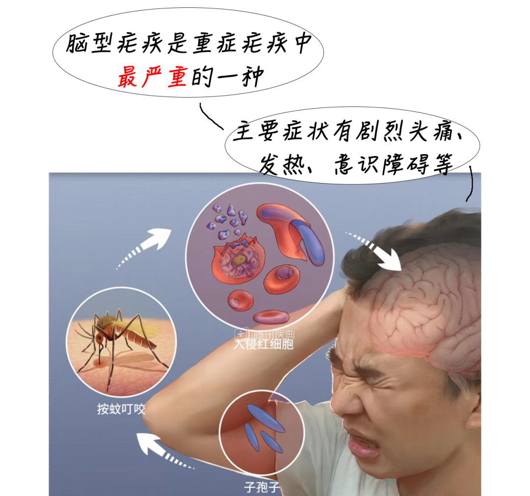 传播疟疾的是按蚊,也称为"疟蚊";造成感染的,既不是细菌也不是病毒
