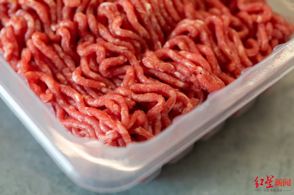 ↑肉类中的大肠杆菌可能导致尿路感染