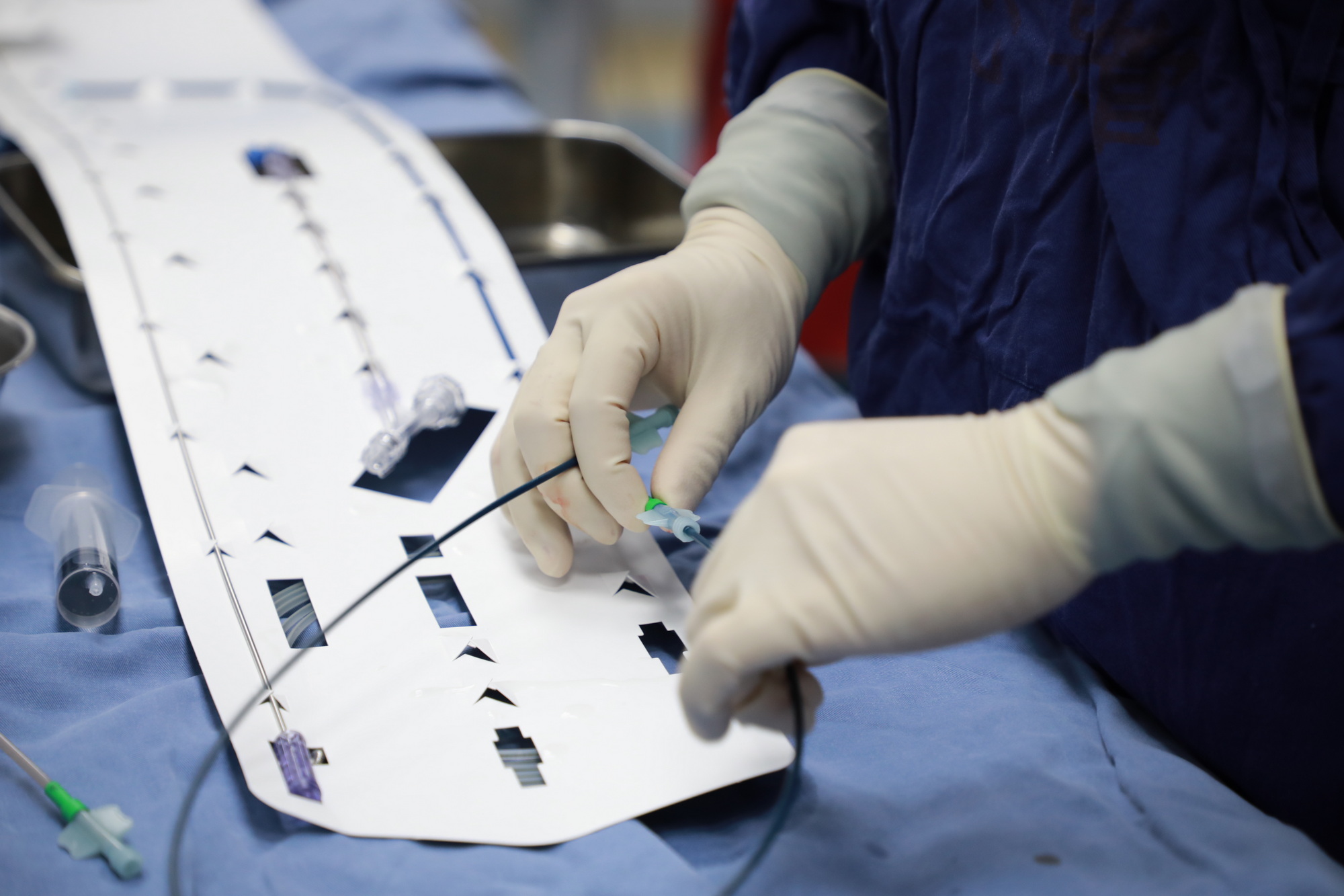 省果洛藏族自治州的先心病患儿手术时使用的直径仅4毫米的介入导管