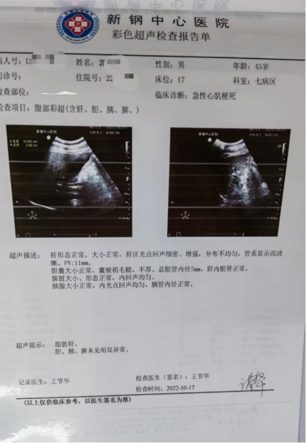 胎儿心电图正常报告单图片