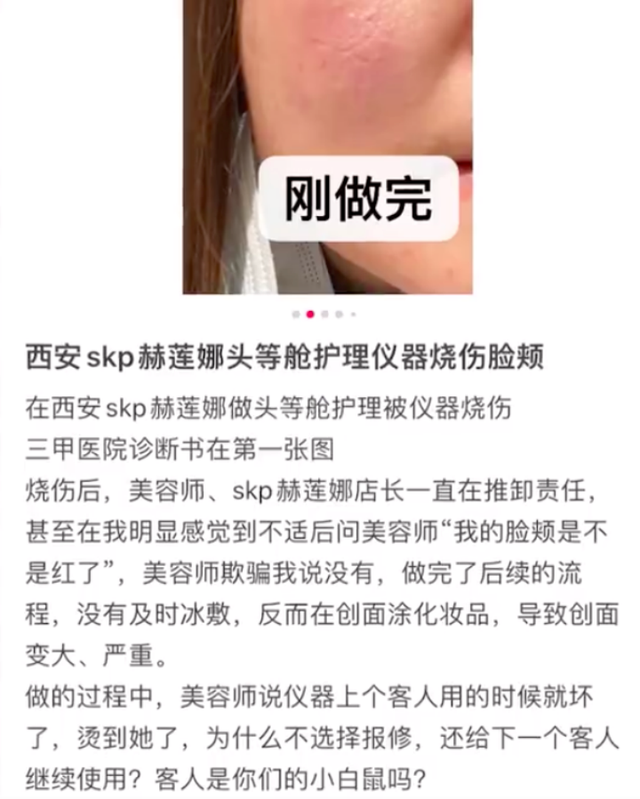 网友曝在赫莲娜做护理致脸部烧伤,工作人员回应:公司已经介入