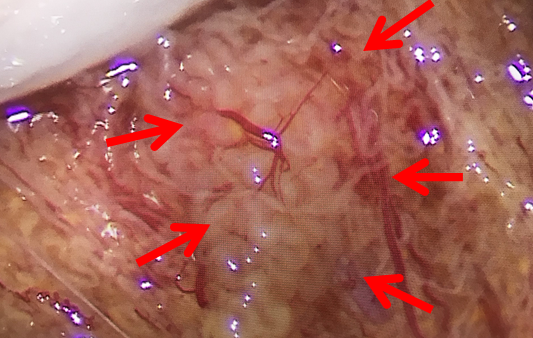 　　红色箭头所示区域为含有精子的生精小管