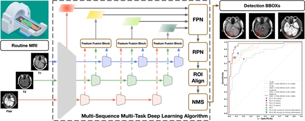 基于常规多序列 MRI的深度学习 CVST诊断算法流程