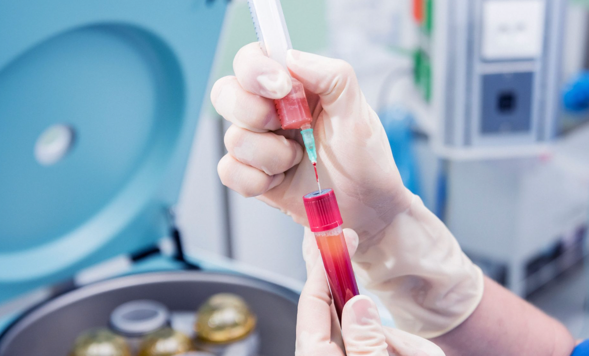 医学分离出来的PRP（富血小板血浆 ）