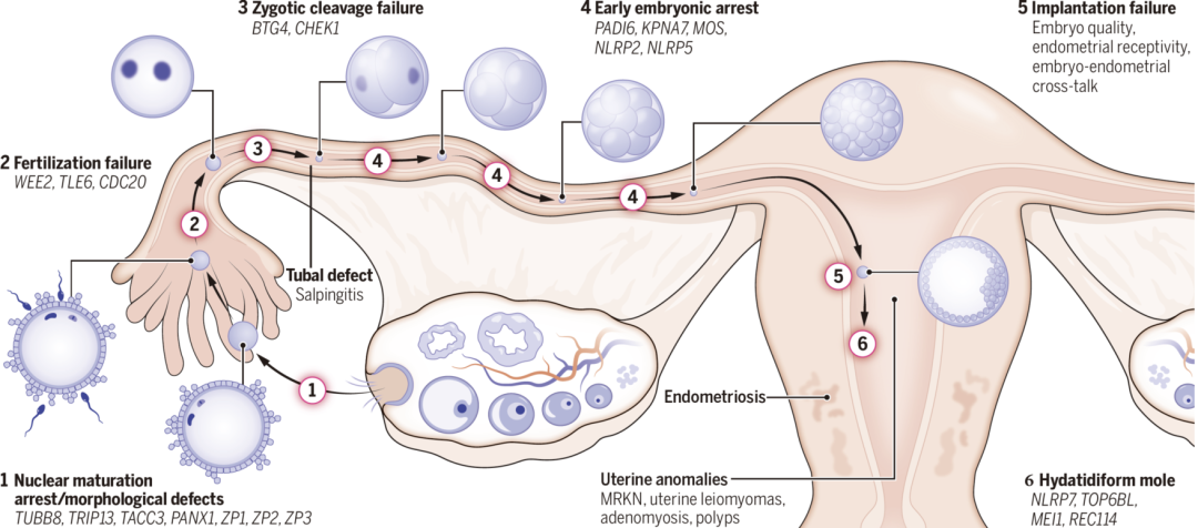 图2 不同类型卵子、受精及胚胎发育异常及致病基因