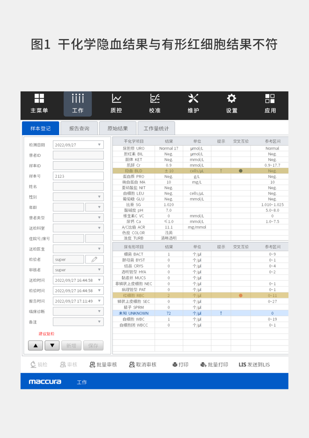 干化学是什么仪器看得懂的尿液分析-上海聚慕医疗器械有限公司