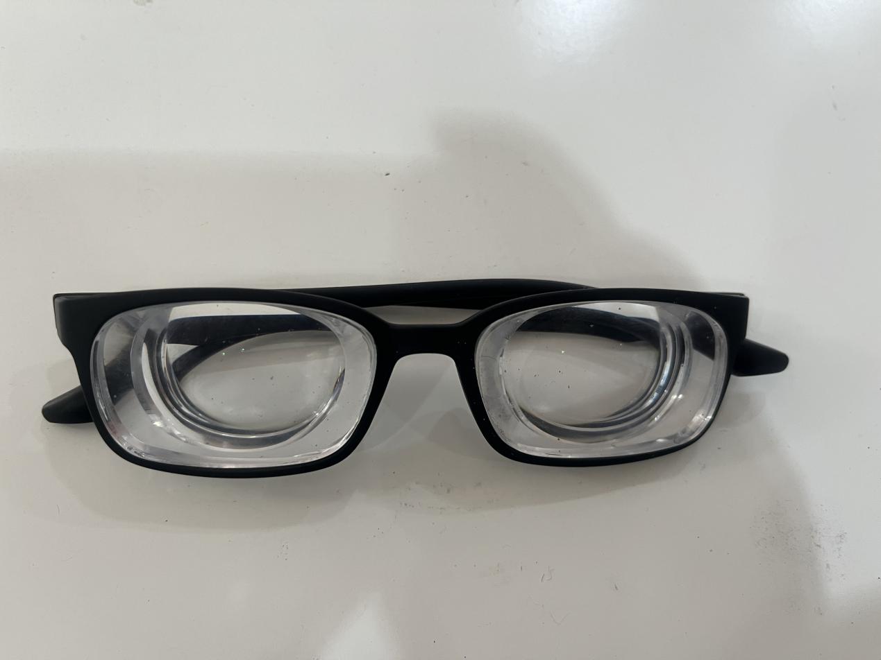 55岁的他2900度近视:从陕西来沪就医,临走前医护人员