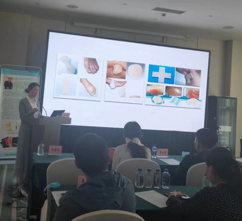 成大附属医院吴书杰医师分享了科室再生医疗技术在剥脱性皮炎患者的应用。