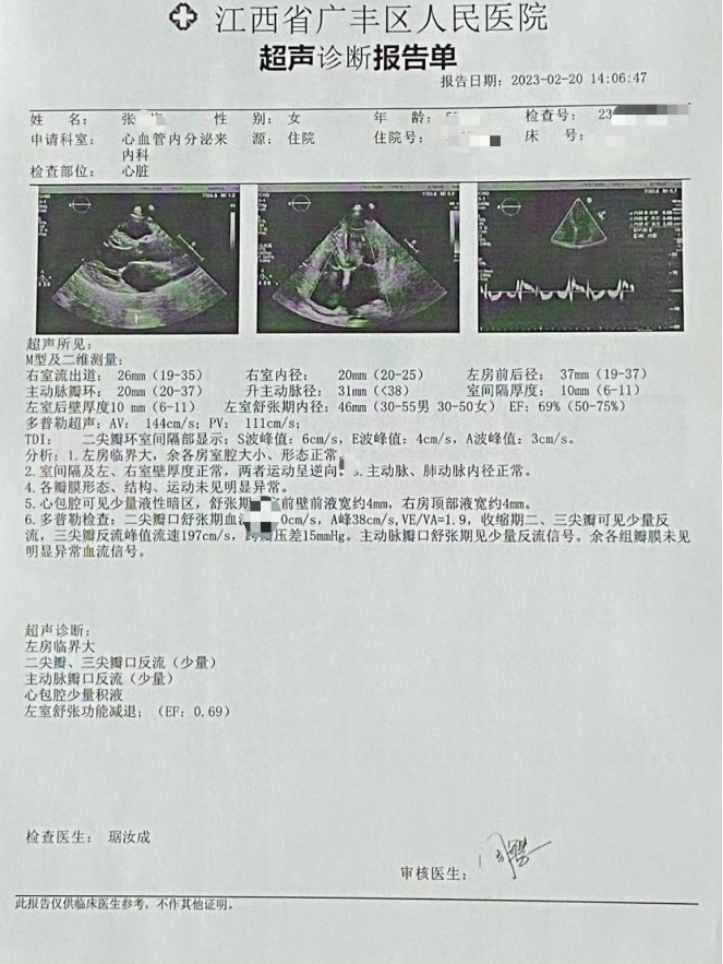 活心丸(浓缩丸)治疗病例之74—慢性心功能不全急性加重的女性患者
