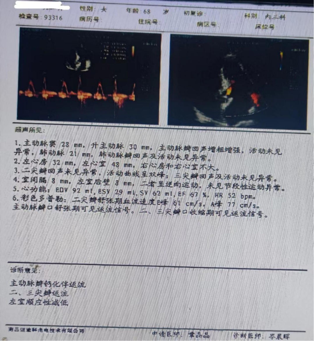 活心丸(浓缩丸)治疗病例之75—冠心病不稳定性心绞痛的老年女性患者