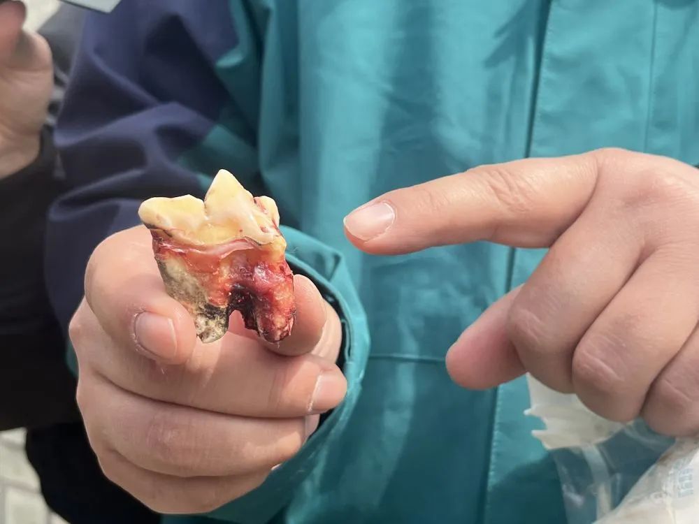 4月24日,工作人员为记者展示拔掉的虎牙.新华社记者 赵丹丹 摄