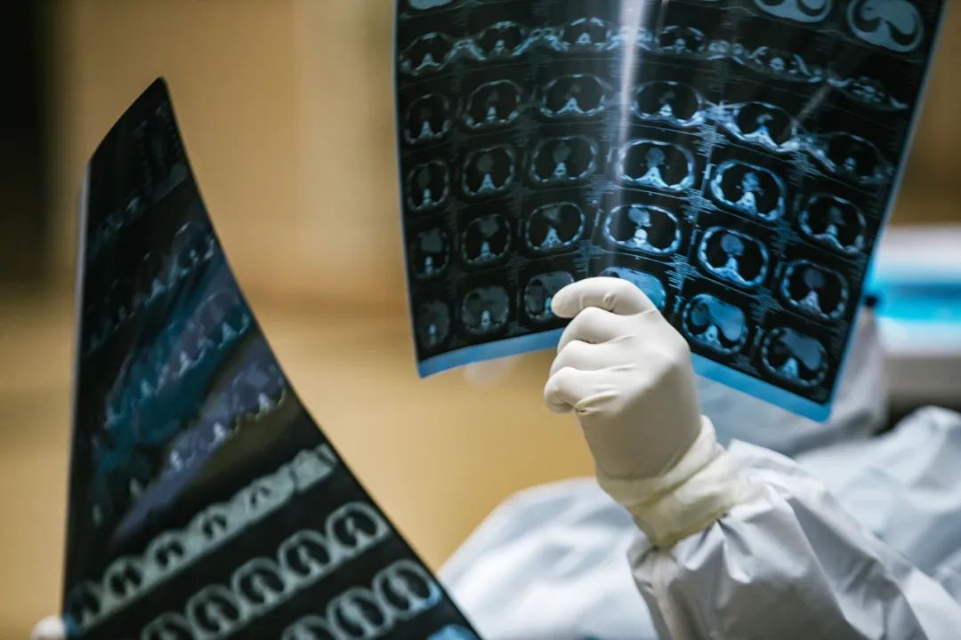 医生查看患者的胸部ct 图片来源:每经记者 张建 摄