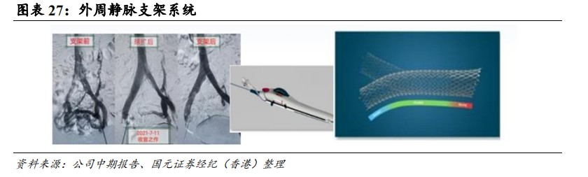 cordis公司怎么样国元国际：予归创通桥-B(02190)“买入”评级 神经和外周血管介入龙头有望迎来快速增长_https://www.jmylbn.com_新闻资讯_第24张
