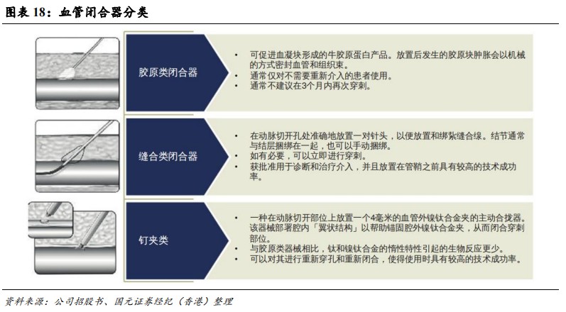 cordis公司怎么样国元国际：予归创通桥-B(02190)“买入”评级 神经和外周血管介入龙头有望迎来快速增长_https://www.jmylbn.com_新闻资讯_第15张