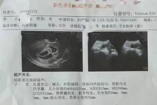 31岁女子产后9个多月再怀孕,她做了个决定|四胞胎_新浪财经_新浪网