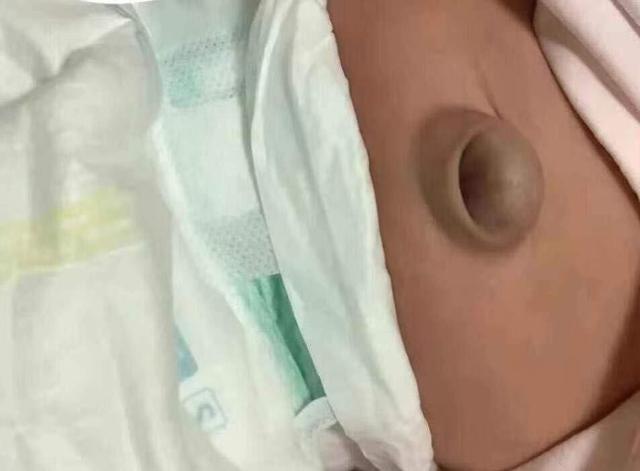 中药熏蒸床怎么熏蒸江津区妇幼保健院中医康复科：“绿色中医”，呵护妇幼健康_https://www.jmylbn.com_新闻资讯_第3张