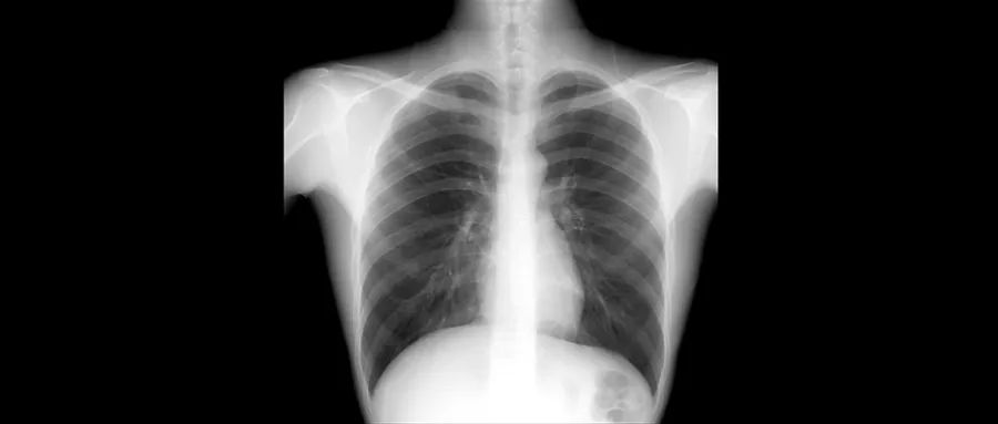 为生命坚守|尘肺病_新浪财经_新浪网