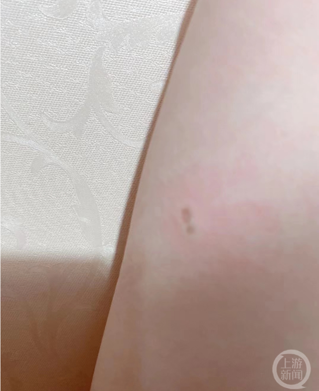 ▲网民&ldquo;醒&rdquo;手臂被电后留下的印记。 图片来源/受访者供图