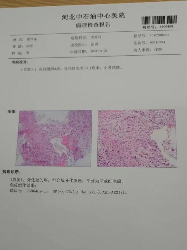数次被判死刑,羁押22年后患胃癌,廊坊灭门案第4次二审明日开庭