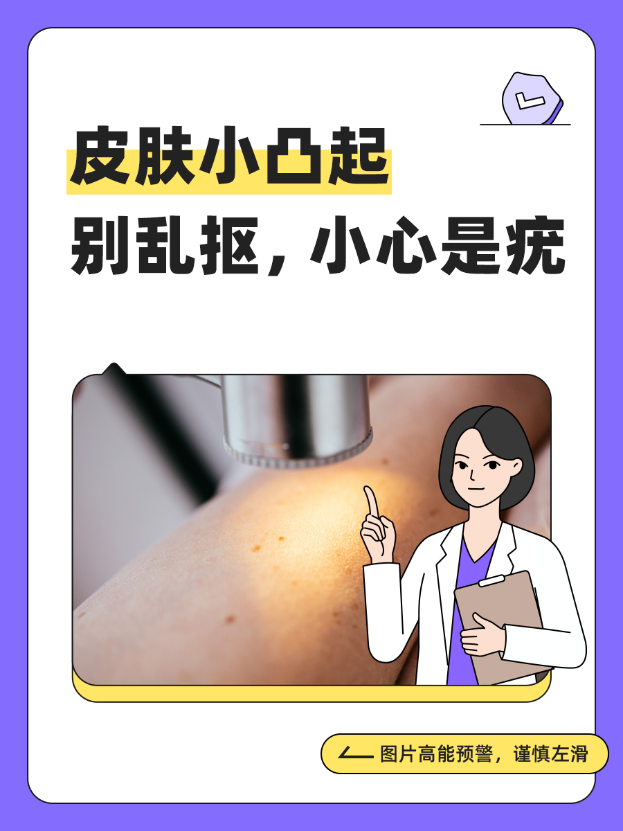 皮肤上 5 种小凸起其实是疣,乱抠小心会传染_新浪财经_新浪网