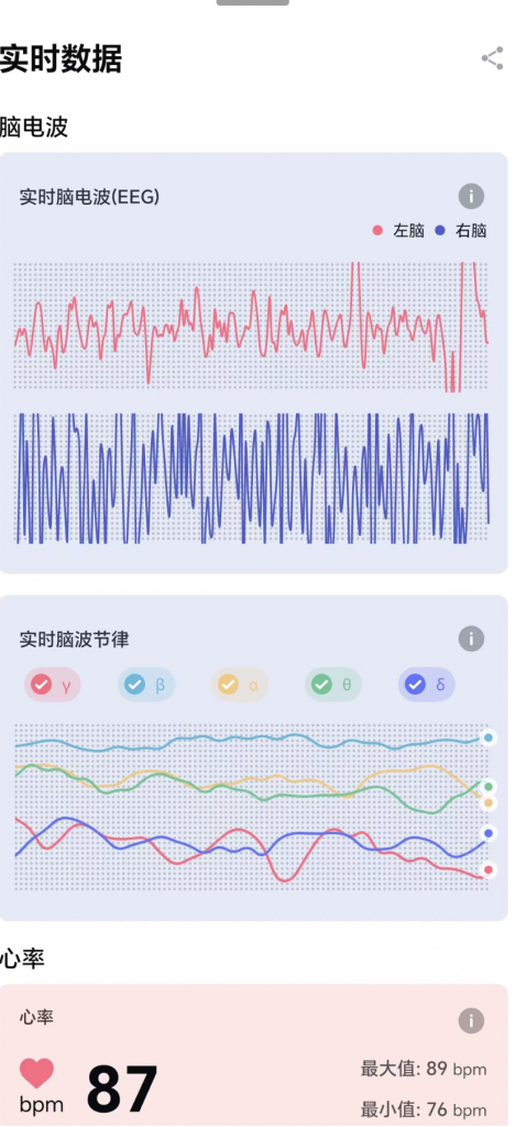 【亿境展台还展出了脑机接口的探索XR机器】