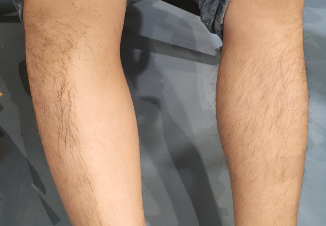 用它,我脱了男同事 25 年的腿毛!|上海市_新浪财经_新浪网