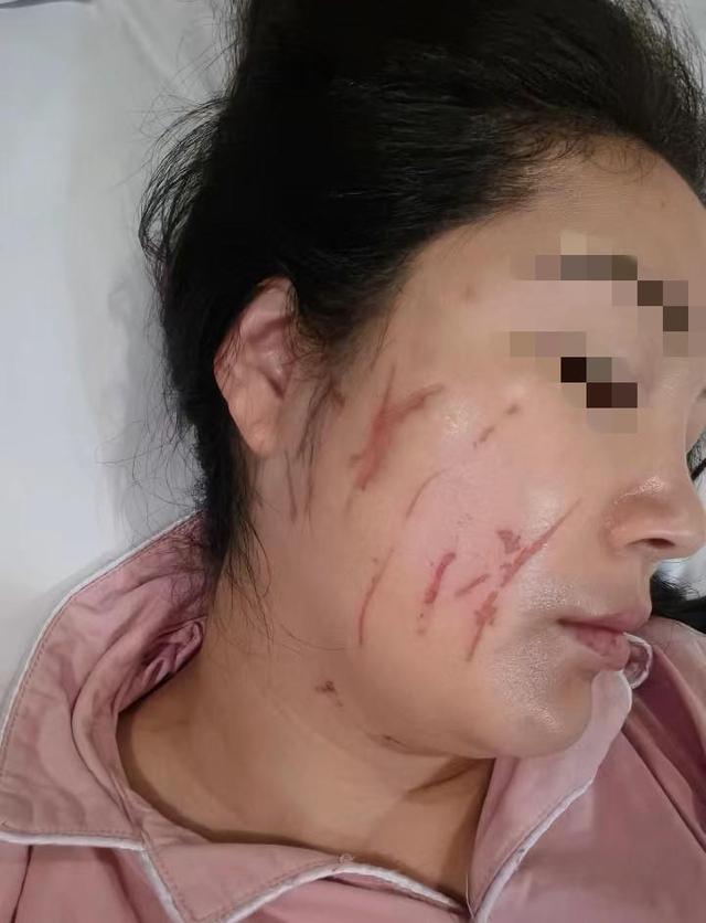 驻马店一男子称被妻子家暴 当事女子亦发布自己带伤