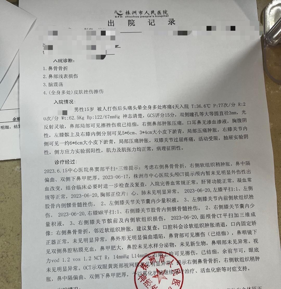 出院记录显示,王女士的弟弟被诊断为鼻骨骨折,脑震荡等