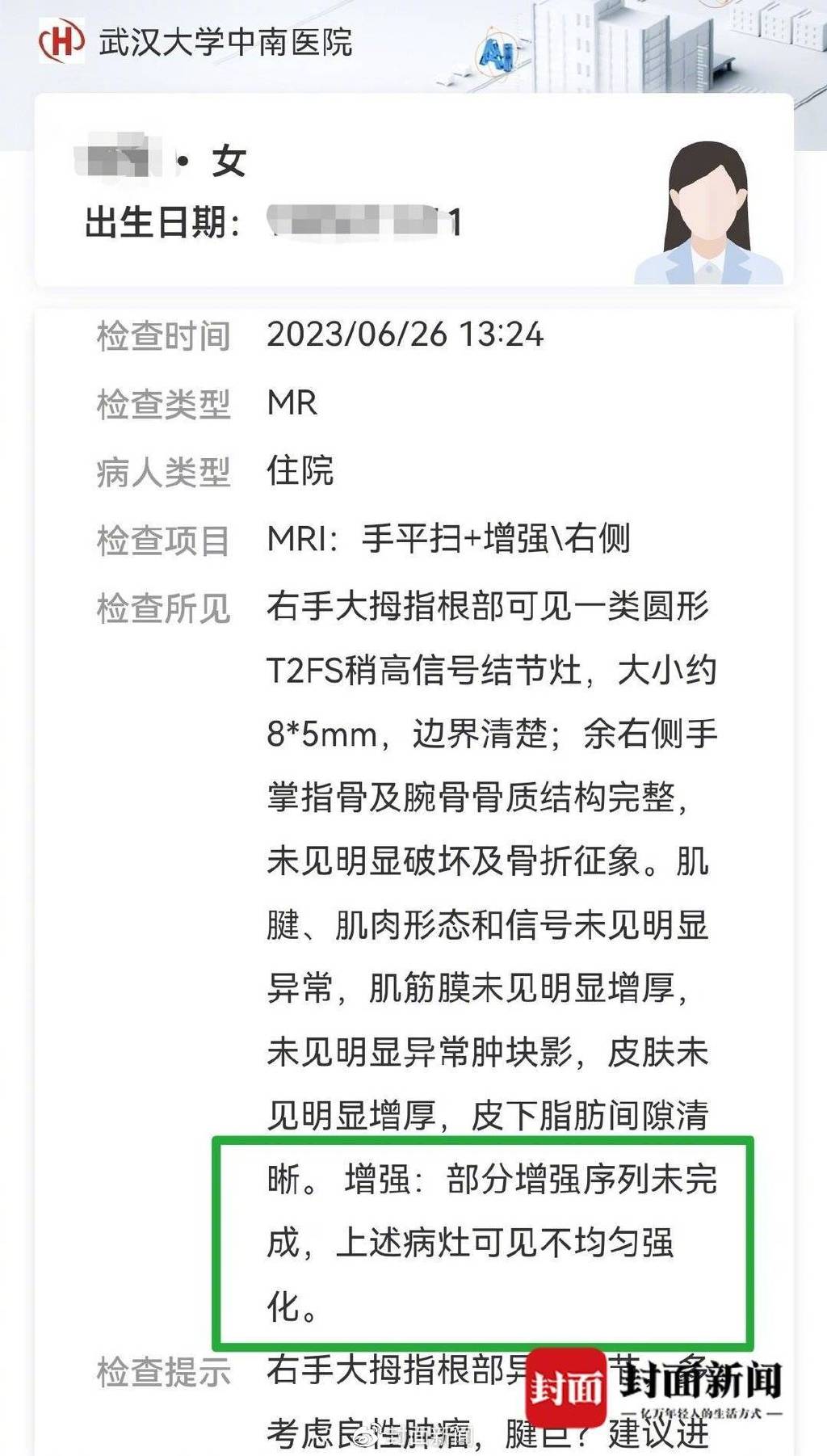 武汉女子做核磁共振遇险:造影剂过敏喊不出声,两次蜷腿求救后送icu