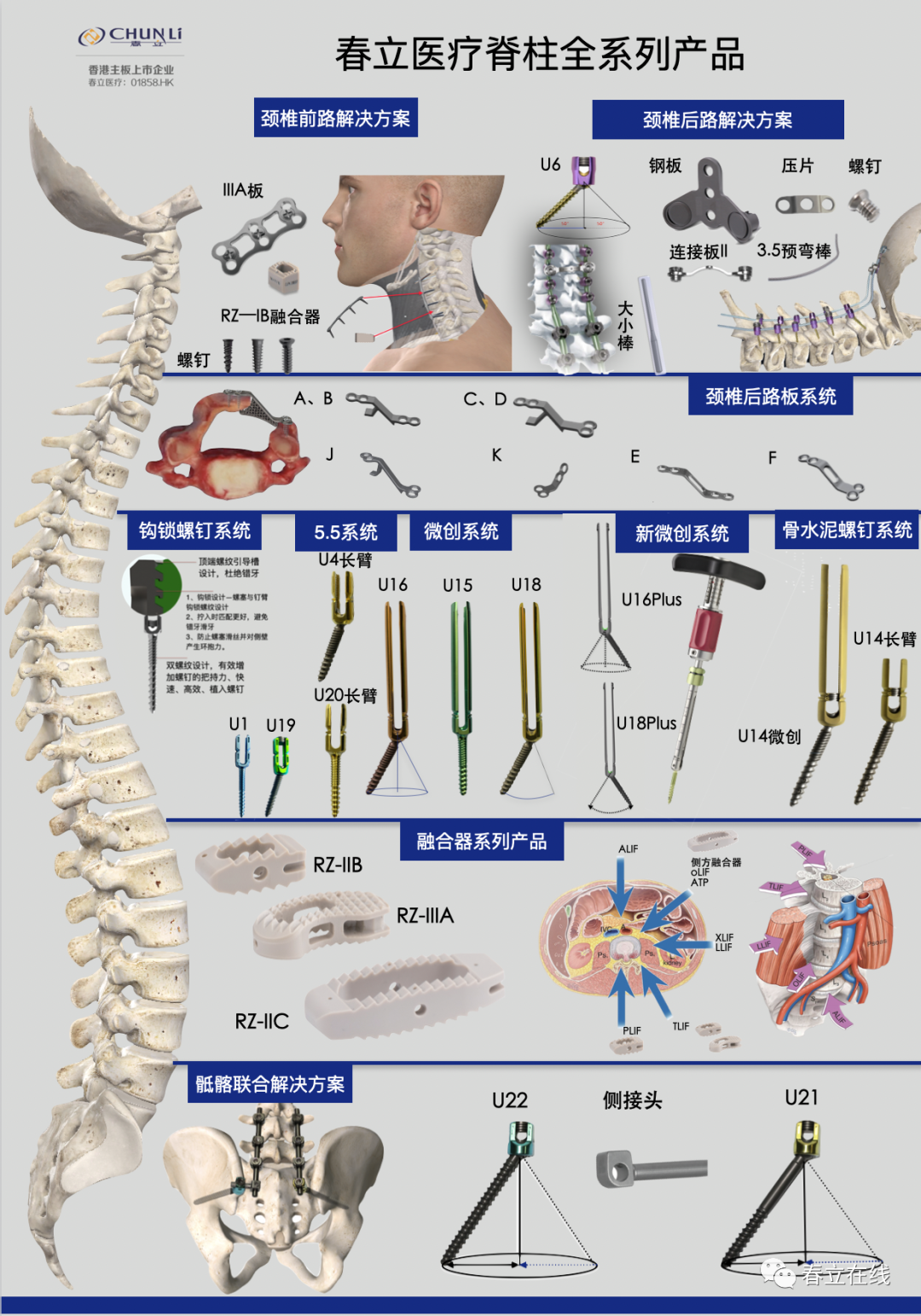 【产品推荐】腰椎椎弓根(pedicle screw,ps)置钉技术