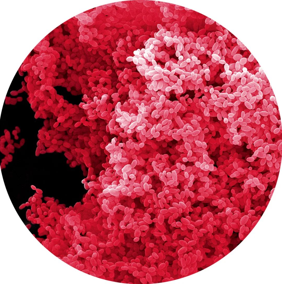 黄广华团队分离出的东南亚念珠菌细胞电镜.图/受访者提供