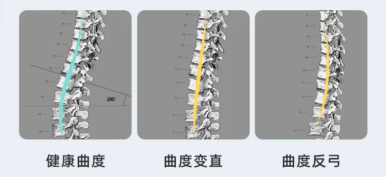 为了帮打工人护腰,乐班历时5年研究,提出"腰椎健康的曲度应该保持在26