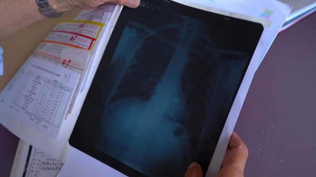 距离颜怀俭心脏5毫米的地方,一枚2×1厘米的弹片在那里已经呆了整整70