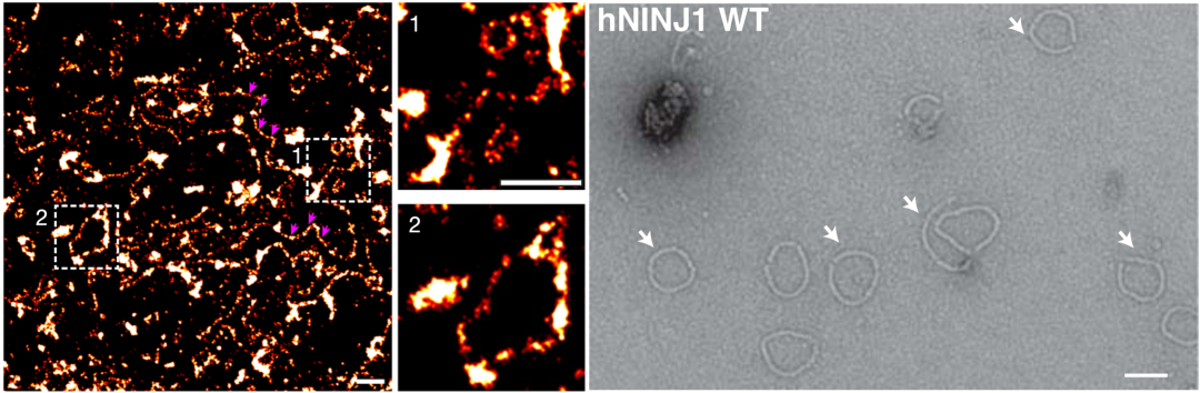 超分辨率显微镜下看到的NINJ1聚集体（左图：NINJ1丝，右图：双丝打开后成的环）