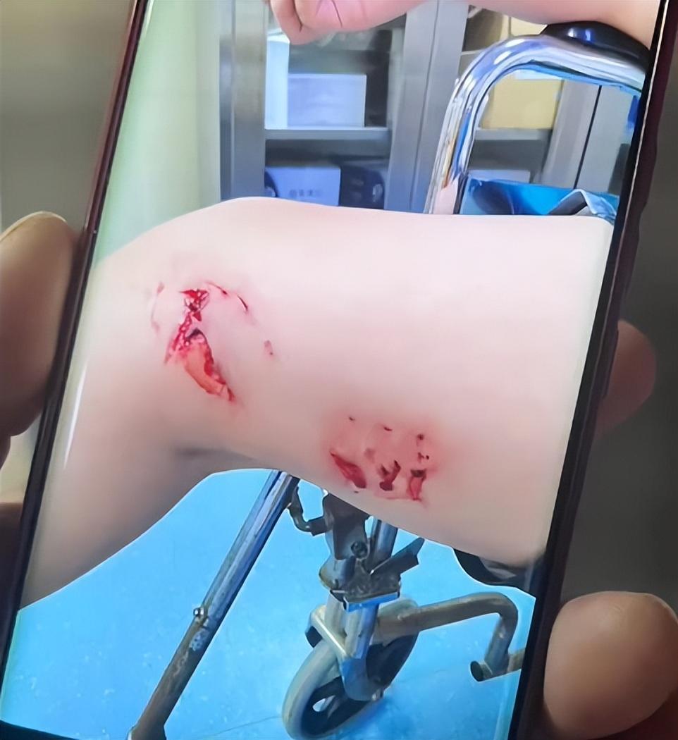 北海一浴场游客疑被鱼类咬伤生物专家基本排除油锥雪茄达摩鲨海狼鱼