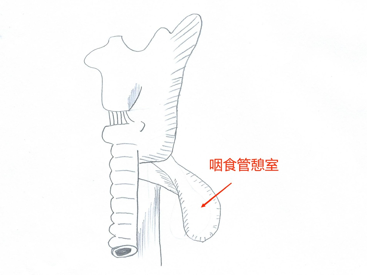 七旬老人进食困难半年暴瘦30斤,中山医院多学科协作重