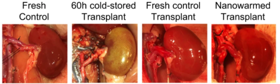 （从左到右分别是新鲜肾脏、冷冻60小时后移植的肾脏（失败）、新鲜移植的肾脏、纳米加热后移植的肾脏）