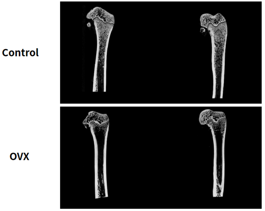 雌性sd大鼠卵巢切除10周后,股骨离体扫描显示:ovx组骨小梁明显减少.