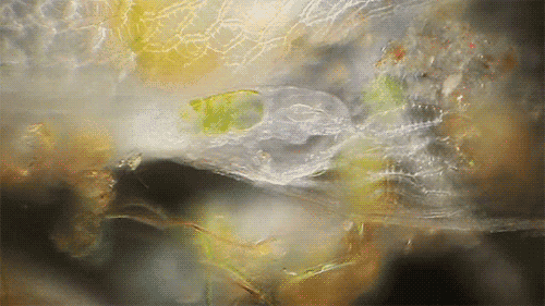 高度显倍镜下穿了一天的内裤上的虫卵细菌