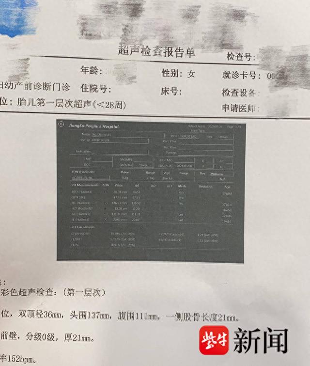 【孕妈日记2】孕16周时,我第一次听到了胎心音