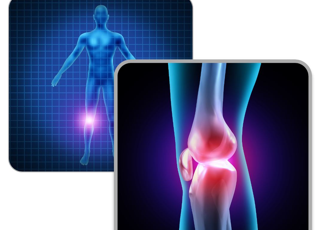 什么波治疗仪【康复之声】体外冲击波疗法在髌下脂肪垫炎中的临床应用_https://www.jmylbn.com_新闻资讯_第1张