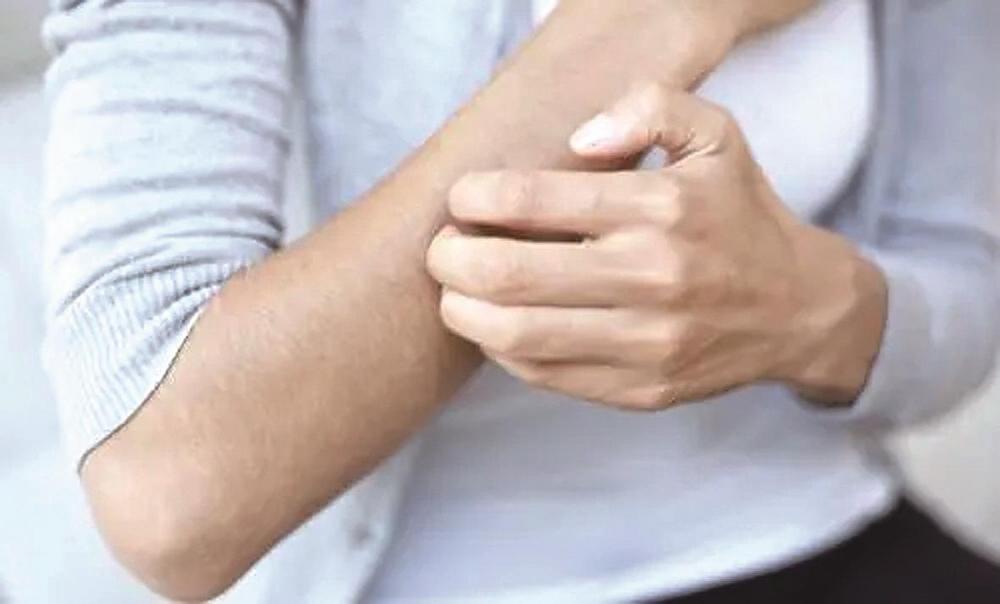 搔抓后虽能短暂缓解,却难以根除.