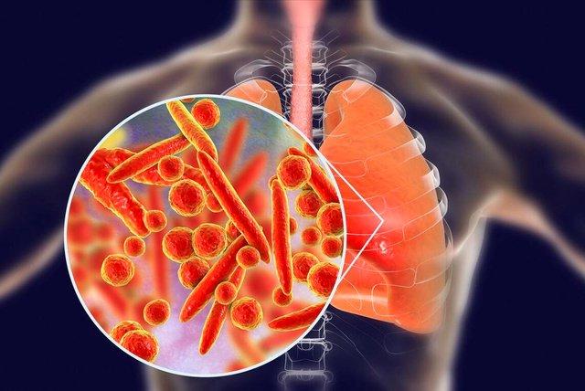 肺炎支原体感染是一种介于细菌和病毒之间的致病性微生物。