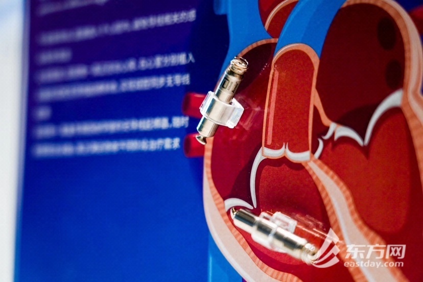 什么是电生理导管提前“解锁”前沿科技 这位“老友”将在进博期间展示众多创新解决方案_https://www.jmylbn.com_新闻资讯_第3张