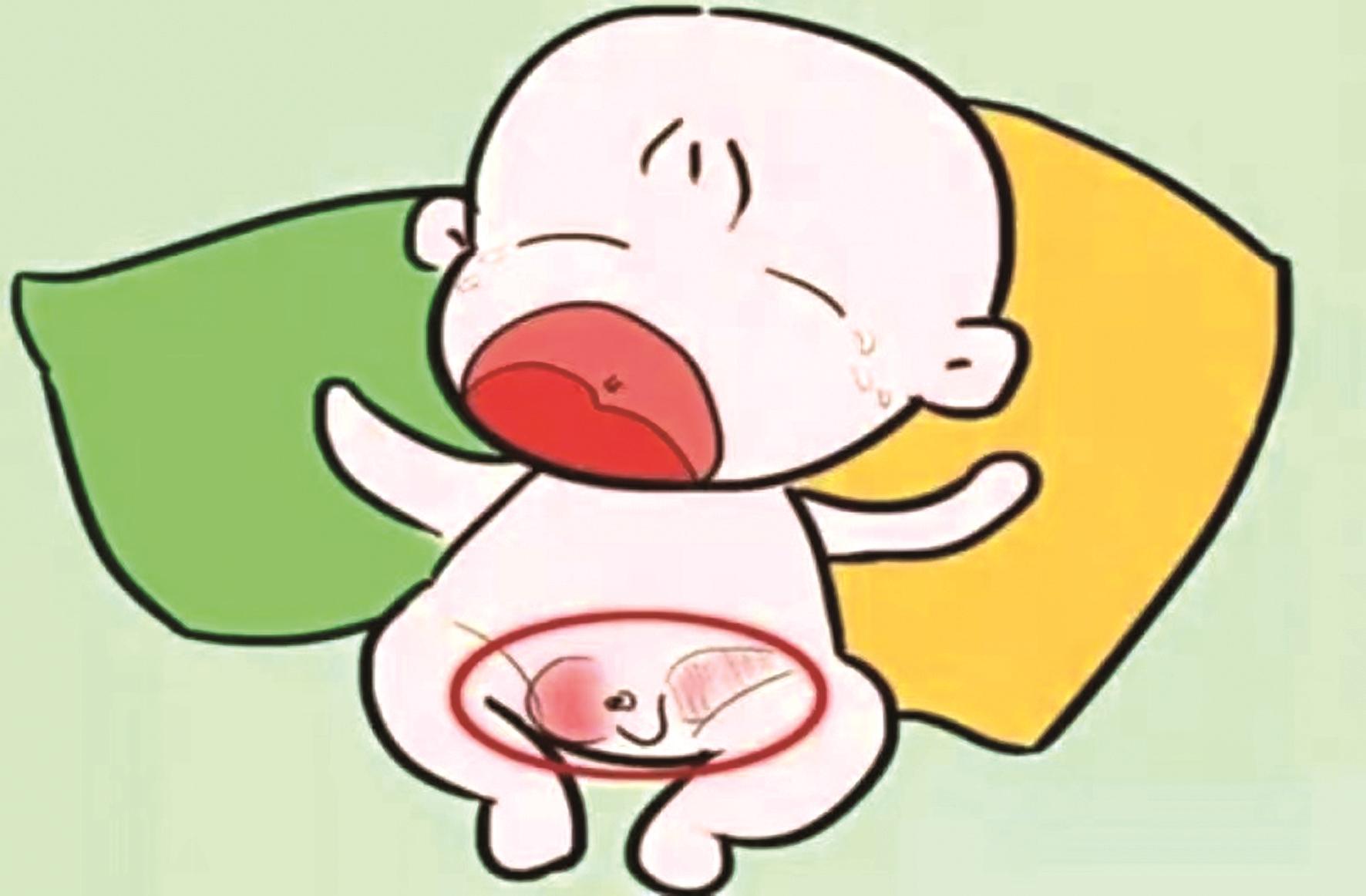 男宝宝一定得注意这一点：睾丸出现一个包，可能是疝气！ - 知乎