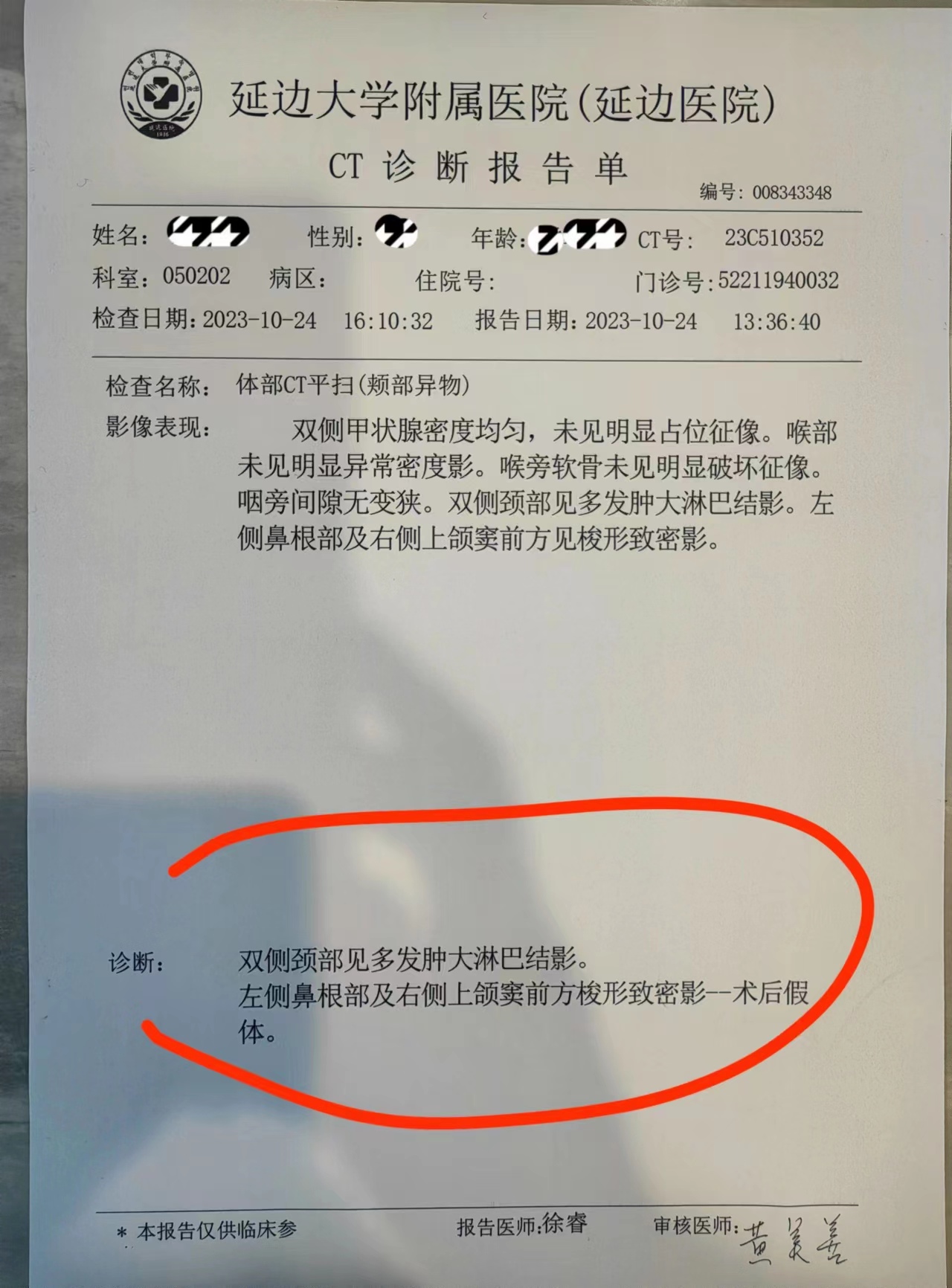 该医院出具的ct诊断报告单的诊断结果写明:"左侧鼻根部及右侧上颌窦